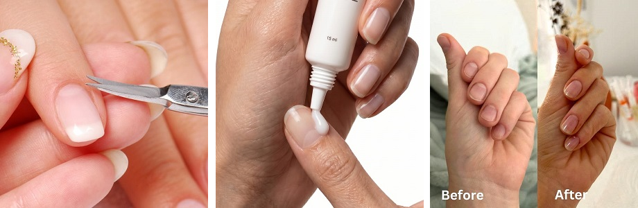 Cuticle remover